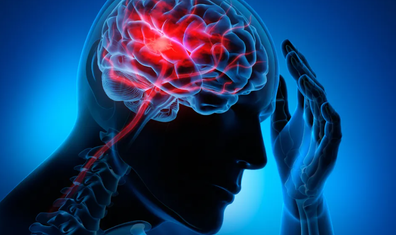 Rubrique Santé : CE QU’IL FAUT SAVOIR SUR L ‘AVC Rubrique Santé : CE QU’IL FAUT SAVOIR SUR L ‘AVC
