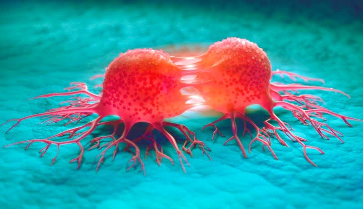 RUBRIQUE SANTÉ : Pourquoi de Plus en Plus de Jeunes Développent un Cancer ? RUBRIQUE SANTÉ : Pourquoi de Plus en Plus de Jeunes Développent un Cancer ?