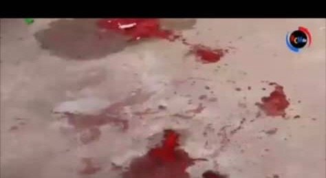 RDC : 2 MORTS ET 3 BLESSÉS GRAVES, BILAN DE LA FUSILLADE DE CE DIMANCHE A MUANDA AU KONGO CENTRAL RDC : 2 MORTS ET 3 BLESSÉS GRAVES, BILAN DE LA FUSILLADE DE CE DIMANCHE A MUANDA AU KONGO CENTRAL