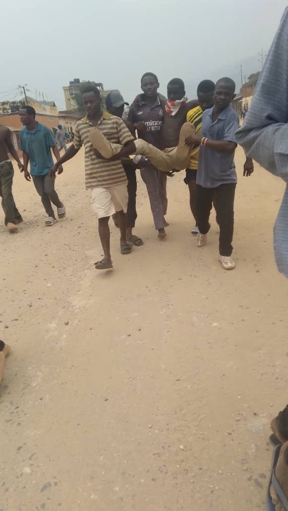RDC : 1 MORT ET 9 BLESSÉS , BILAN PROVISOIRE DES ÉCHAUFFOURÉES DE CE LUNDI À UVIRA RDC : 1 MORT ET 9 BLESSÉS , BILAN PROVISOIRE DES ÉCHAUFFOURÉES DE CE LUNDI À UVIRA