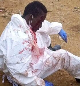 RDC / BENI : RIPOSTE CONTRE L&rsquo;EPEDEMIE D&rsquo; EBOLA, UN AGENT AGRESSÉ 48 HEURES APRÈS L&rsquo;INCENDIE D&rsquo;UNE AMBULANCE À ARU